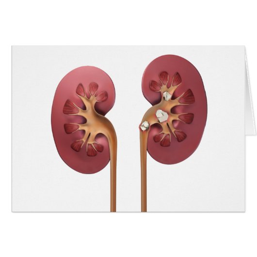 kidneys (Front Horizontal)