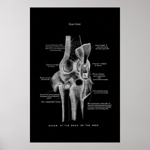 Knee Joint Anatomy Medical Wall Decor