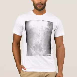 L-5/S1 CT Scan-initialed-by KLM T-Shirt