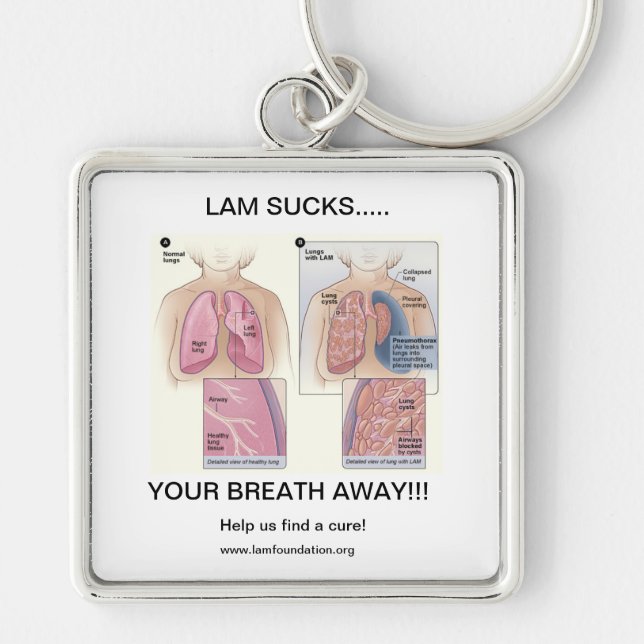 LAM SUCKS KEYCHAIN (Front)