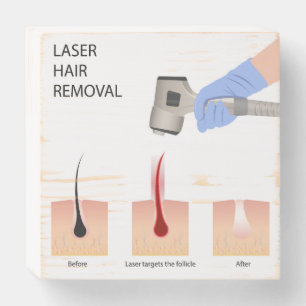 Laser hair removal Wooden Box Sign