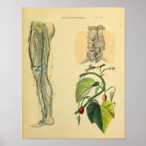 Leg Lymphatics Veins Anatomy Vinatge Art Print
