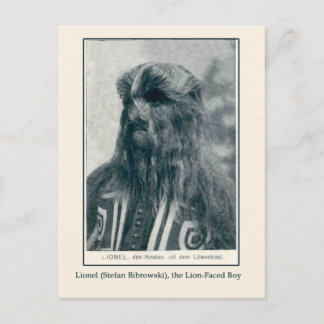 Lionel, the Lion Faced Boy Cards and Postcards