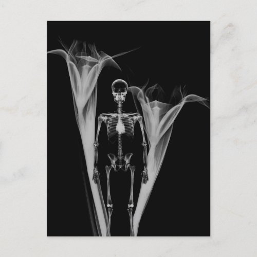 Little Human X_Ray Skeleton  Flowers _ BW Postcard