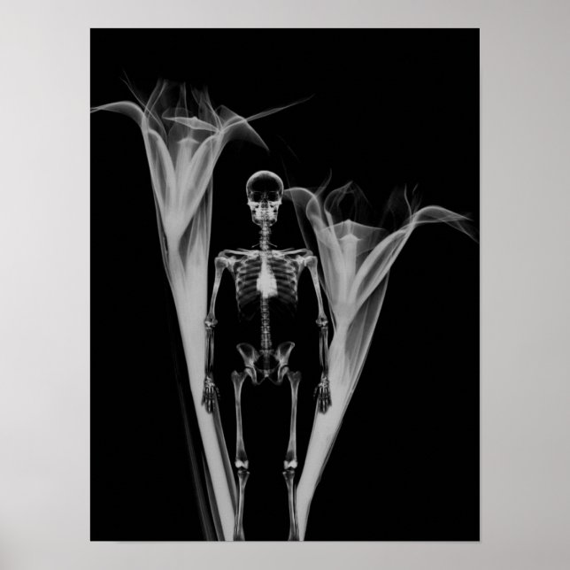 Little Human X-Ray Skeleton & Flowers - B&W Poster (Front)