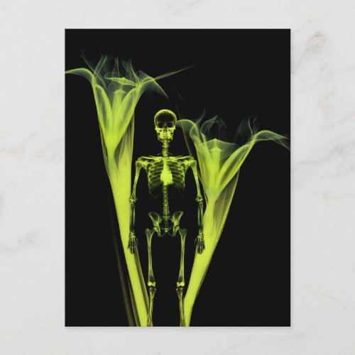 Little Human X_Ray Skeleton  Flowers _ Lime Green Postcard