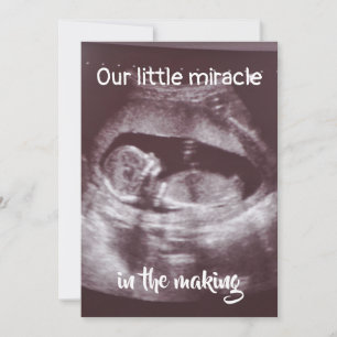 Little Miracle Ultrasound 2 Photo Baby Family Announcement