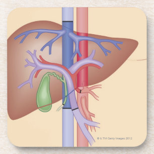Liver Transplant Procedure Drink Coaster