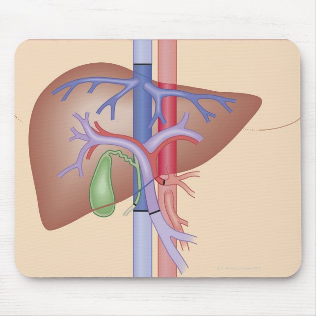 Liver Transplant Procedure Mouse Pad (Front)