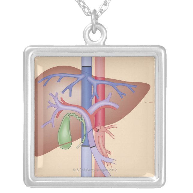 Liver Transplant Procedure Silver Plated Necklace (Front)