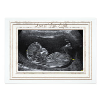 Love at First Sight Pregnancy Announcement