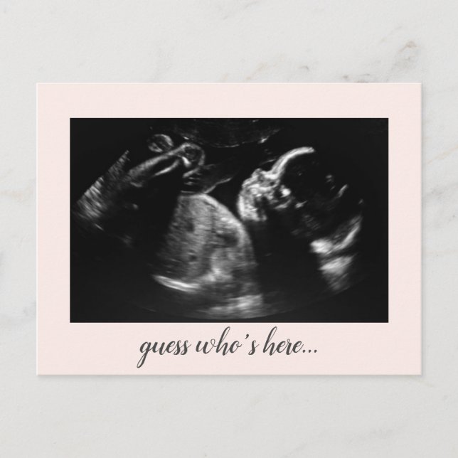 Love to birth baby Girl Birth Announcement (Front)