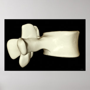 Lumbar Vertebra 4 Poster