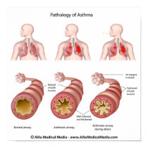 Lung disease Asthma Poster