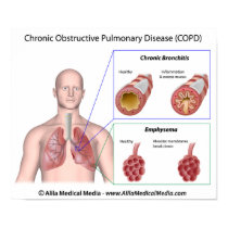 Lung disease COPD labeled Poster