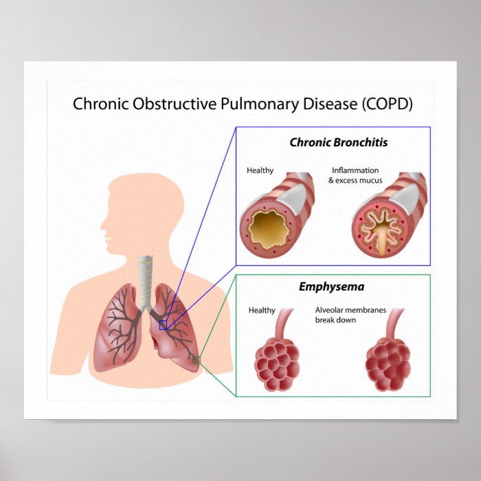 Lung disease (COPD) Poster