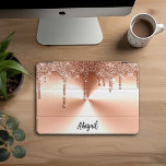 Luxury Sparkle Rose Gold Dripping Glitter Personal iPad Pro Cover<br><div class="desc">Beautiful Luxury Sparkle Rose Gold Dripping Glitter With Brushed Metal Texture Design Personalized iPad Pro</div>