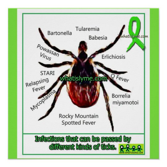 lyme-disease-co-infection-educational-chart-zazzle