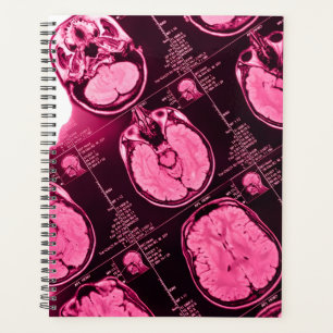  Magenta MRI: An Axial View of the Brain Planner