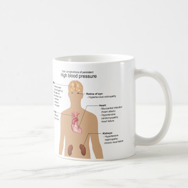 Main Complications of High Blood Pressure Chart Coffee Mug (Right)