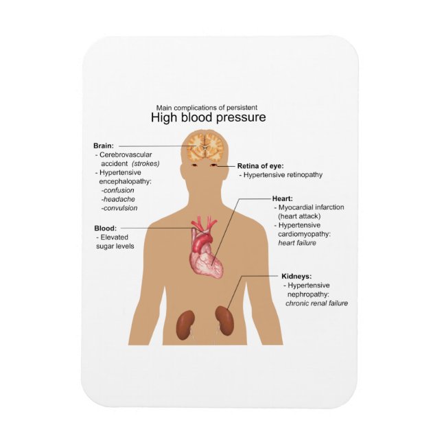 Main Complications of High Blood Pressure Chart Magnet (Vertical)