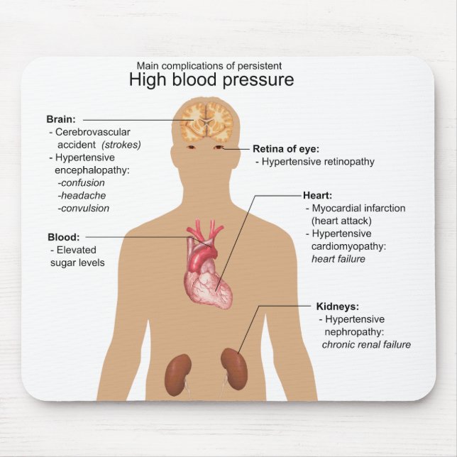 Main Complications of High Blood Pressure Chart Mouse Pad (Front)