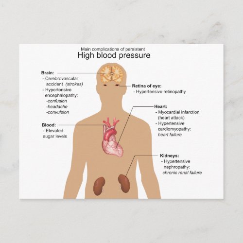 Main Complications of High Blood Pressure Chart Postcard