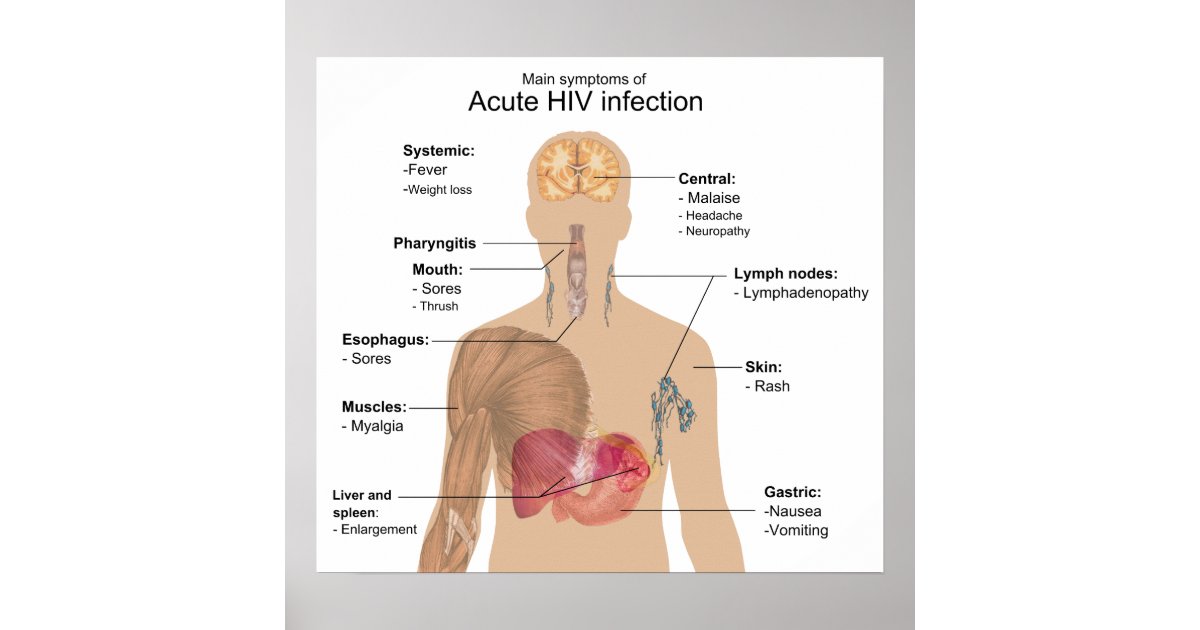 Main Symptoms of Acute HIV Infection Poster | Zazzle.com