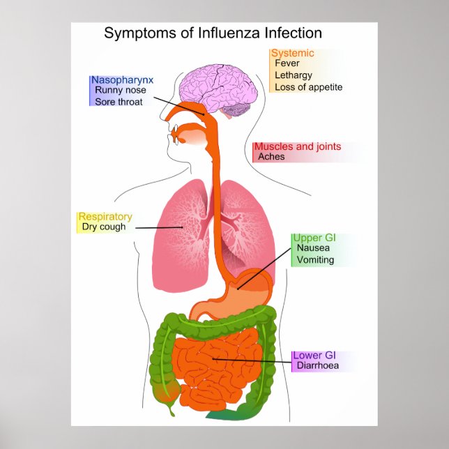 Main Symptoms of an Influenza Infection Diagram Poster (Front)