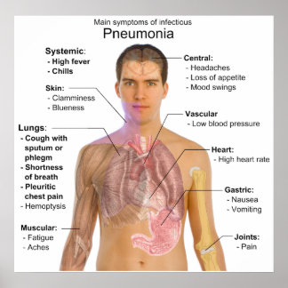 Pneumonia Posters | Zazzle