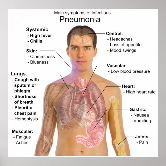 Main Symptoms of Infectious Pneumonia Diagram Poster (Front)