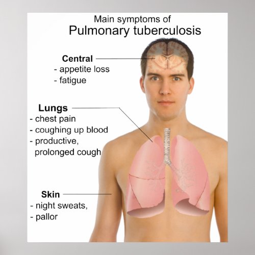 Main Symptoms of Pulmonary Tuberculosis Chart