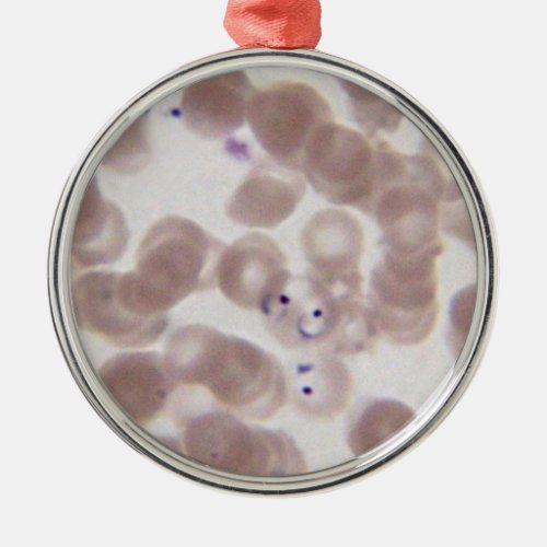 Malaria Plasmodium blood smear Metal Ornament