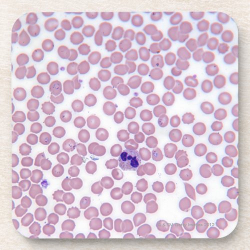 Malarial Blood Cells Beverage Coaster