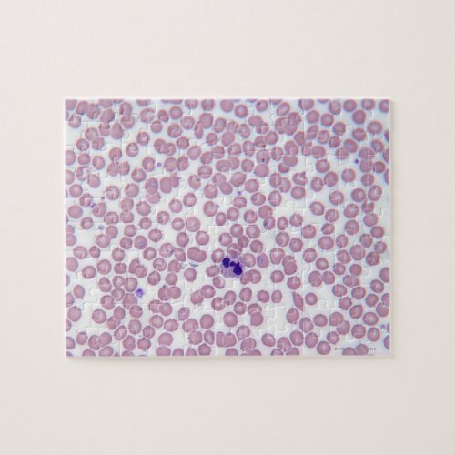 Malarial Blood Cells Jigsaw Puzzle