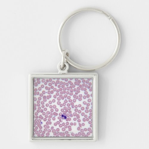 Malarial Blood Cells Keychain