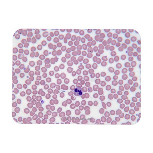 Malarial Blood Cells Magnet