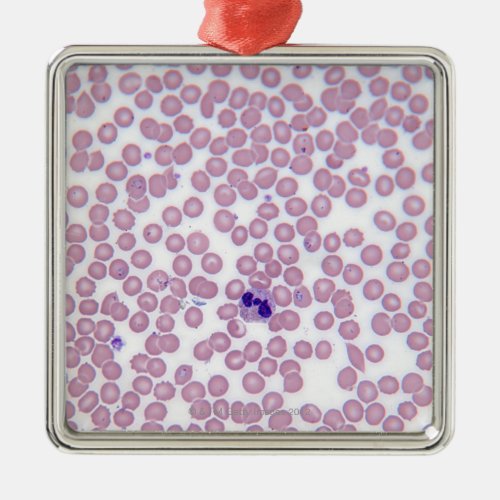 Malarial Blood Cells Metal Ornament