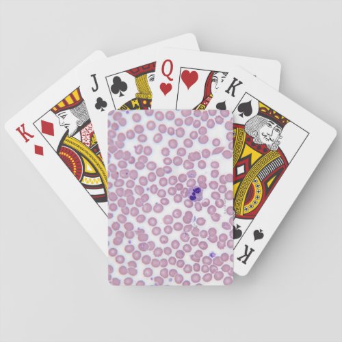 Malarial Blood Cells Playing Cards