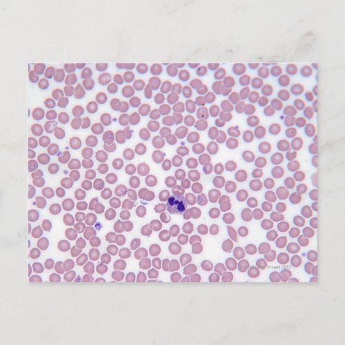 Malarial Blood Cells Postcard