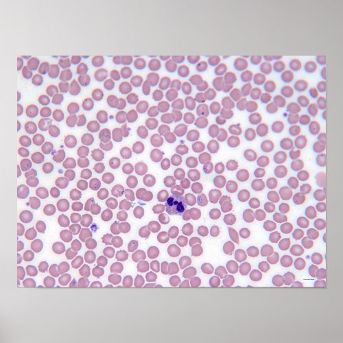 Malarial Blood Cells Poster