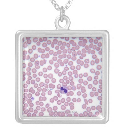 Malarial Blood Cells Silver Plated Necklace
