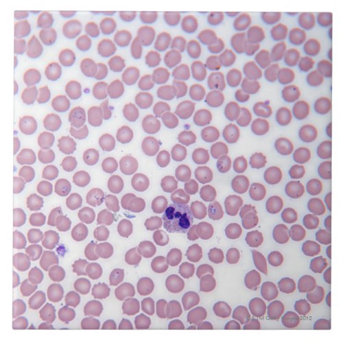 Malarial Blood Cells Tile