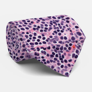 MALT lymphoma Neck Tie