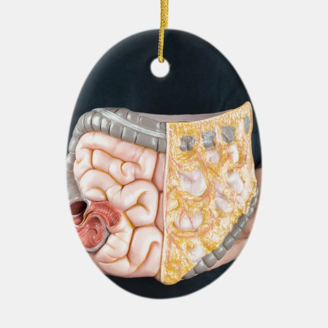Man holding model of human intestines or bowels ceramic ornament (Front)