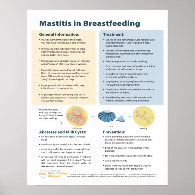 Mastitis in Breastfeeding Poster (English) (Front)