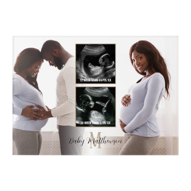 Maternity Journey 4 photos Monogram Initial  Acryl Acrylic Print (Front)