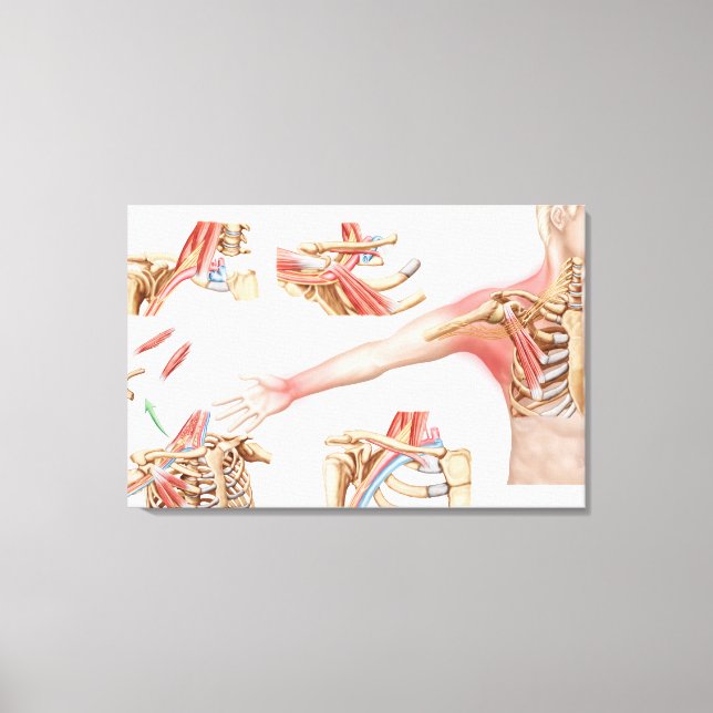 Medical Illustration Detailing Thoracic Outlet Canvas Print (Front)