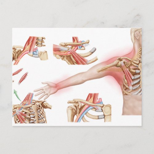 Medical Illustration Detailing Thoracic Outlet Postcard