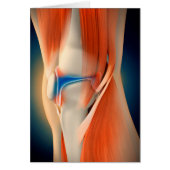 Medical Illustration: Inflammation In Knee (Front)